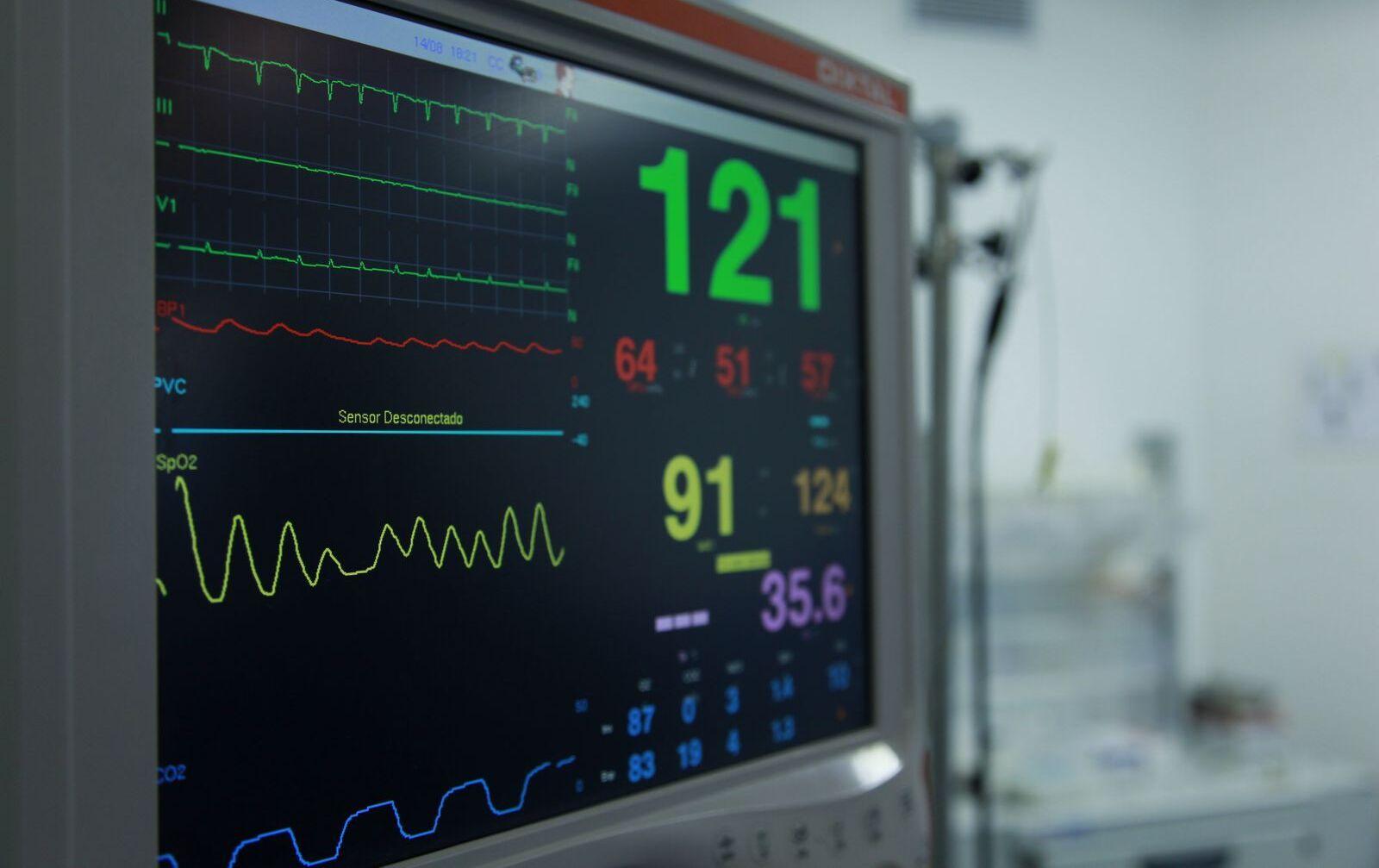 Monitor multiparamétrico mostrando trazos de ECG, presión arterial y saturación de oxígeno