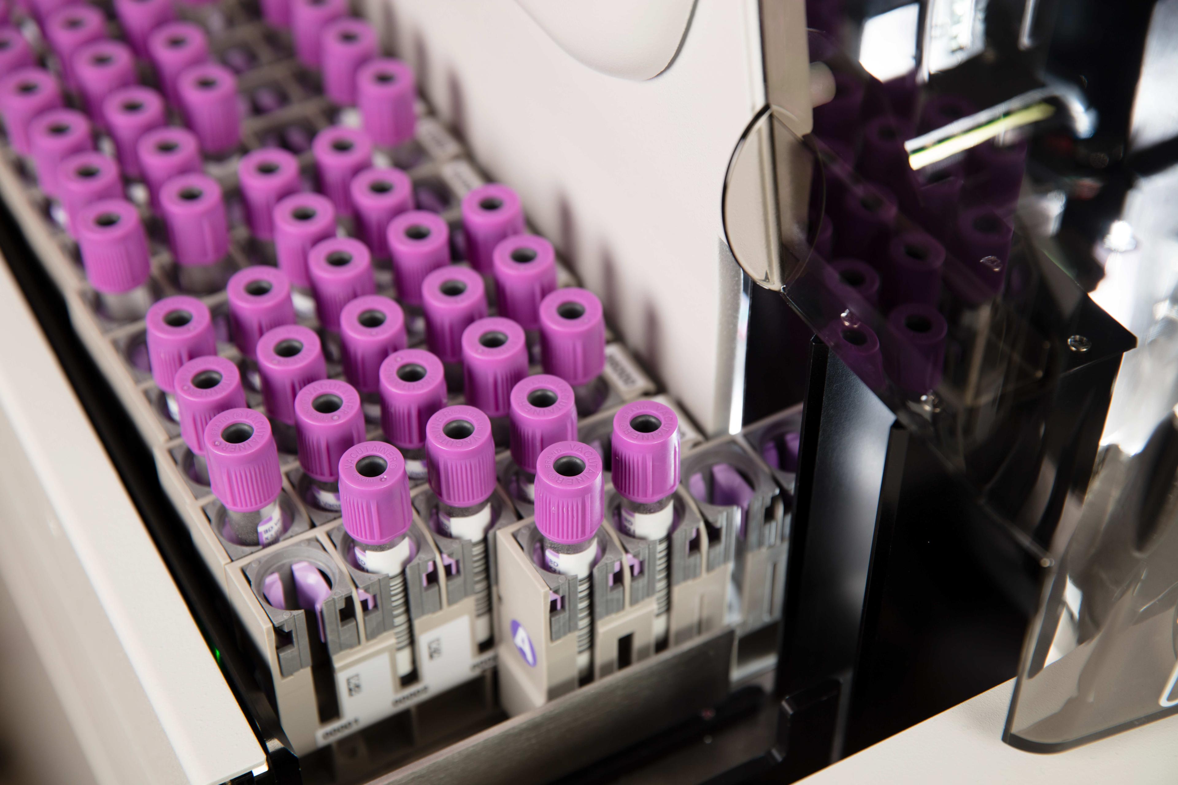 Hematología Promed