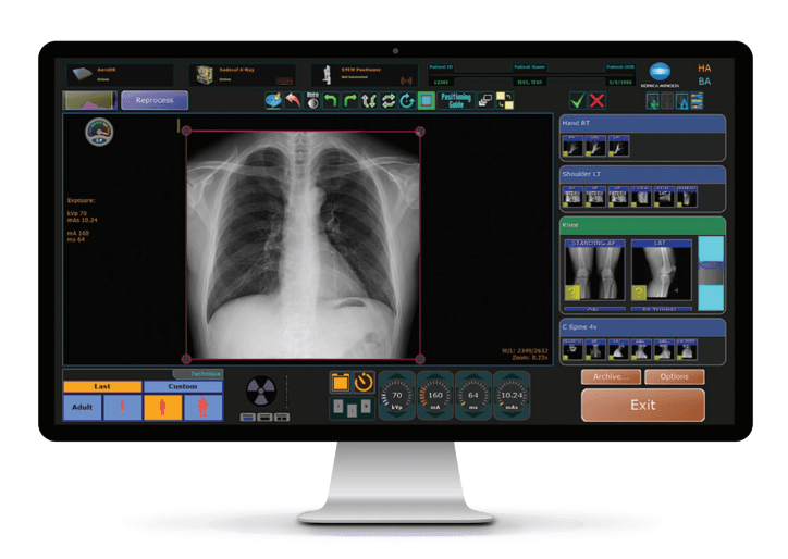 Radiografía digital con sistema de rayos X de Promed
