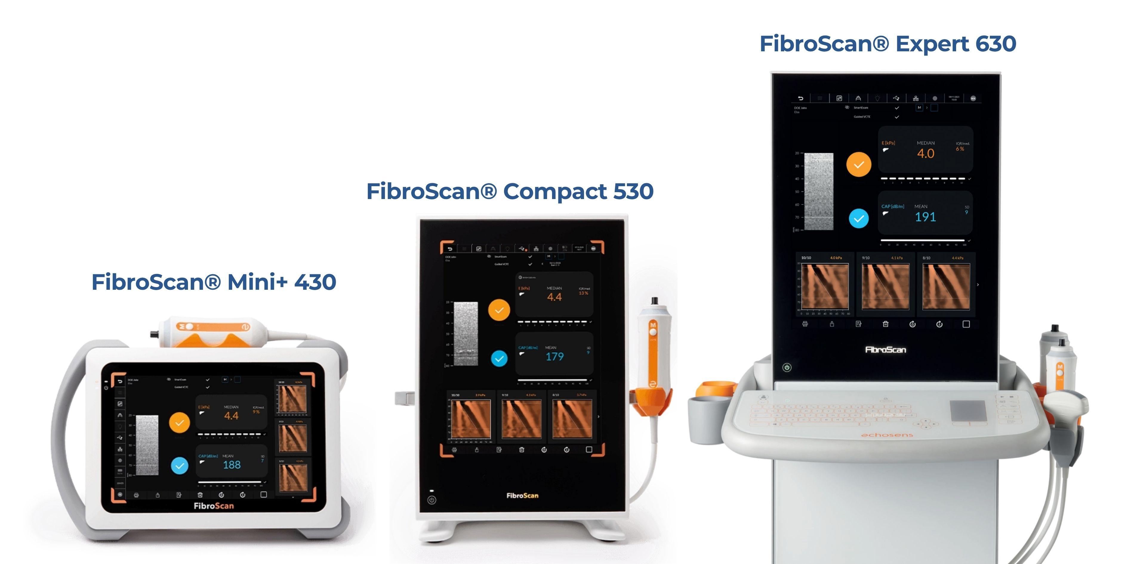 fibroscan